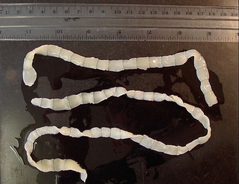 broad tapeworms in the human body