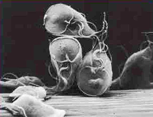 protozoa parasite giardia
